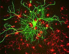 Human Neurofilament H